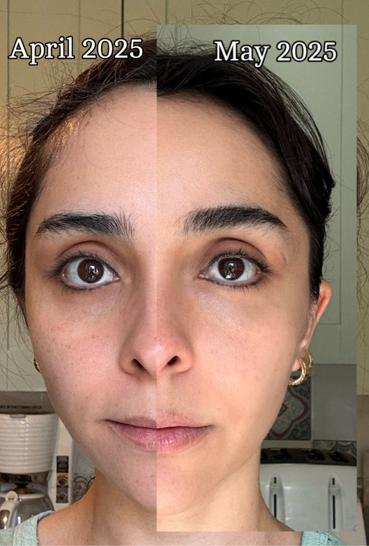 My Skin’s Secret Weapon: A Powerful Month with The Ordinary’s Peptide Serums